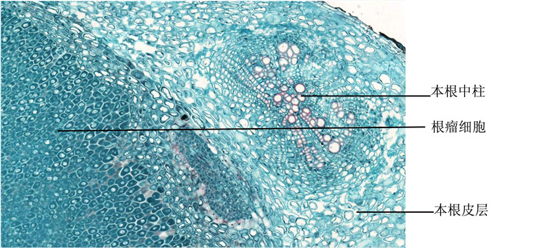 花生根瘤横切-本根和根瘤的 联系1 拷贝.jpg